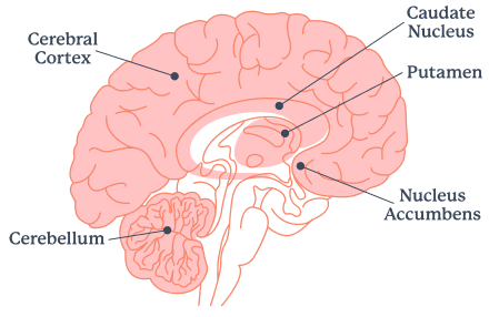 Infographic showing mu opioid receptors in the brain